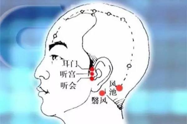 人体穴位图 耳门穴、听宫穴、听会穴