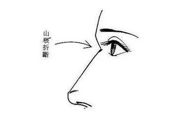 男人山根低是什么样的_山根低_山根低鼻梁高面相
