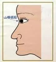 男人山根低是什么样的_山根低_山根低鼻梁高面相